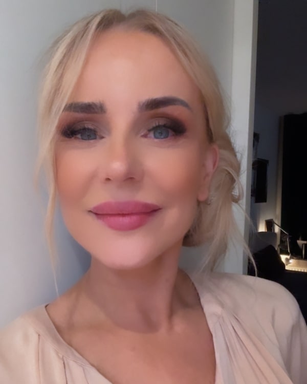 LOVELY-Beauty: Microneedling für zu Hause